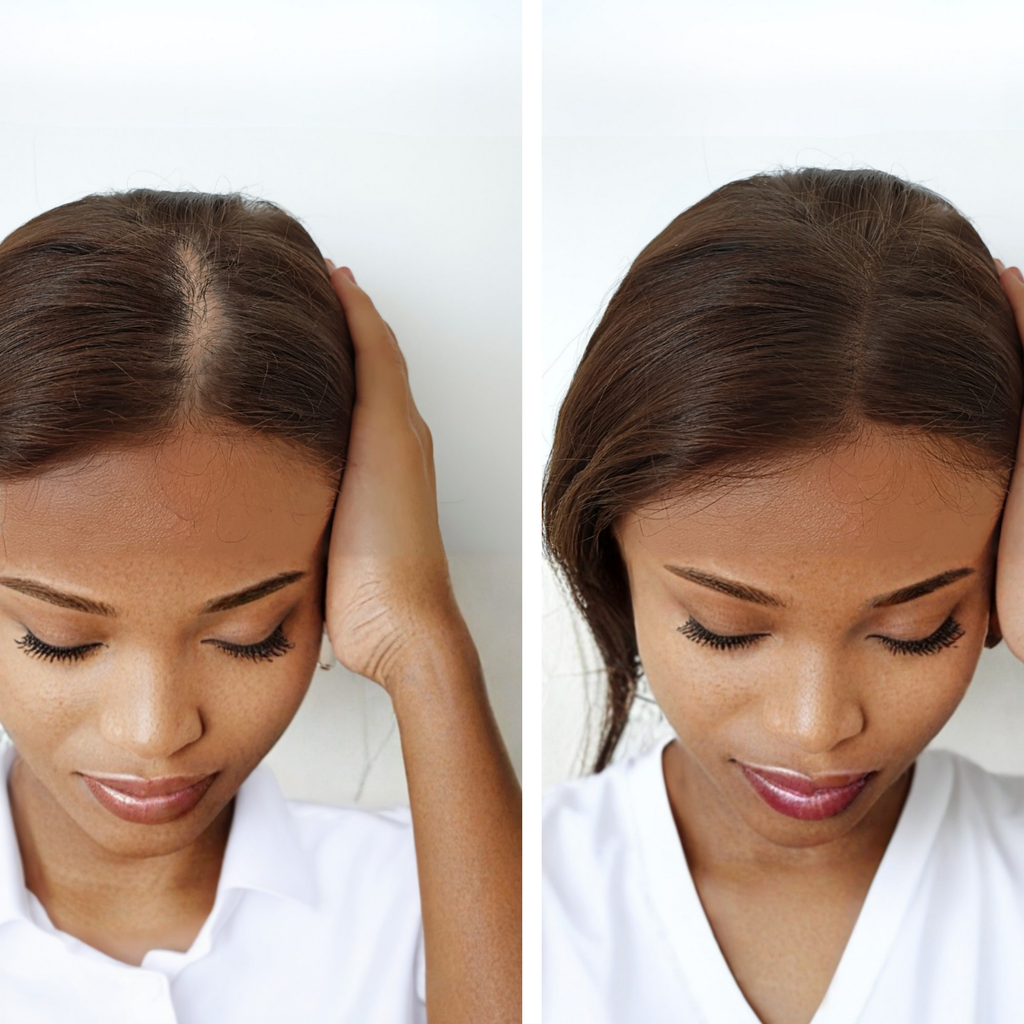 Hair growth scalp oil زيت نمو الشعر